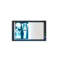 Adjustable Medical LED X Ray Imaging Film Viewer View Box X Ray Film Viewer